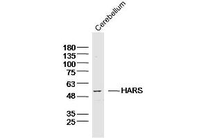 Mouse cerebellum lysates probed with HARS Polyclonal Antibody, Unconjugated  at 1:300 dilution and 4˚C overnight incubation. (HARS1/Jo-1 antibody  (AA 21-120))