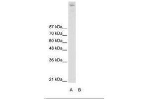 Image no. 2 for anti-Zinc Finger and BTB Domain Containing 38 (ZBTB38) (N-Term) antibody (ABIN203007) (ZBTB38 antibody  (N-Term))