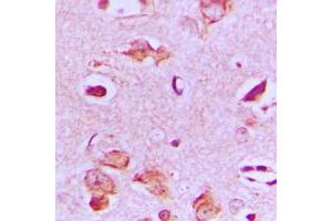 Immunohistochemical analysis of MAST4 staining in human brain formalin fixed paraffin embedded tissue section. (MAST4 antibody  (N-Term))