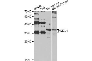Western blot analysis of extracts of various cell lines, using MCL1 antibody (ABIN5970080) at 1/1000 dilution. (MCL-1 antibody  (C-Term))