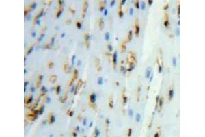 Used in DAB staining on fromalin fixed paraffin-embedded Heart tissue (UGCGL2 antibody  (AA 1221-1408))