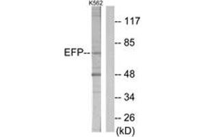 Western blot analysis of extracts from K562 cells, using ZNF147 Antibody. (TRIM25 antibody  (AA 201-250))