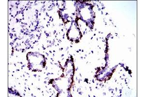 Immunohistochemical analysis of paraffin-embedded prostate tissues using CK5 mouse mAb with DAB staining. (Cytokeratin 5 antibody  (AA 316-590))