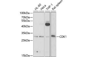 Western blot analysis of extracts of various cell lines, using CDK1 antibody (ABIN6134274, ABIN6138303, ABIN6138304 and ABIN6219543) at 1:1000 dilution. (CDK1 antibody  (AA 208-258))
