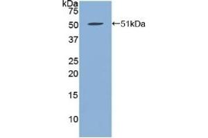Detection of Recombinant FBN1, Human using Polyclonal Antibody to Fibrillin 1 (FBN1) (Fibrillin 1 antibody  (AA 723-902))