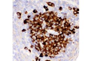 IHC analysis of CD82 using anti-CD82 antibody (ABIN3043486).
