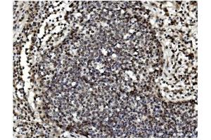 IHC analysis of TET1 using anti TET1 antibody (ABIN7600442). (TET1 antibody  (AA 194-417))