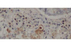 Immunohistochemistry of paraffin-embedded Rat lung using CD68 Polyclonal Antibody at dilution of 1:50 (CD68 antibody)