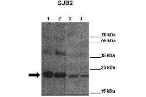 WB Suggested Anti-GJB2 Antibody    Positive Control:  Lane 1: 4ug mCx26 elution fraction 6  Lane 2: 4ug mCx26 elution fraction 7 Lane 3: 4ug mCx26 elution fraction 6 + other Cx26 antibody  Lane 4: 4ug mCx26 elution fraction 7 + other Cx26 antibody   Primary Antibody Dilution :   1:3000  Secondary Antibody :  Anti-rabbit-HRP   Secondry Antibody Dilution :   1:3000  Submitted by:  Juan Zou, Georgia state unviersity (GJB2 antibody  (Middle Region))
