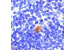 Immunohistochemistry of CARMA1 in mouse thymus with CARMA1 antibody at 10 μg/ml. (CARD11 antibody)