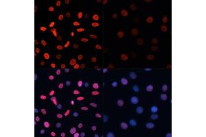 Immunofluorescence (IF) image for anti-Histone H2B (acLys5) antibody (ABIN7267733)
