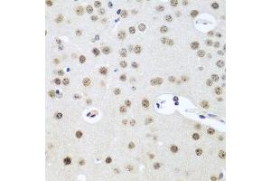 Immunohistochemistry of paraffin-embedded mouse brain using UTP14A antibody at dilution of 1:100 (40x lens). (UTP14A antibody)