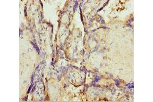 Immunohistochemistry of paraffin-embedded human placenta tissue using ABIN7173219 at dilution of 1:100 (TMEM43 antibody  (AA 80-310))