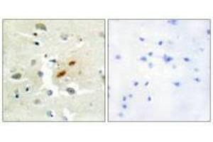 Immunohistochemistry analysis of paraffin-embedded human brain tissue, using DNA Polymerase ζ antibody. (REV3L antibody)