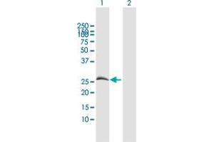 Western Blot analysis of CFHR2 expression in transfected 293T cell line by CFHR2 MaxPab polyclonal antibody. (CFHR2 antibody  (AA 1-270))