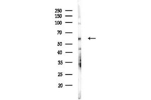 Western blot analysis of lysates from COLO205 cells(UV,30 min treatment), using CDC25C Antibody at 1/1000 dilution.