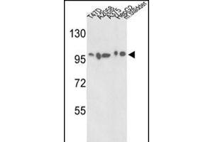Western blot analysis of ACTN4 Antibody (C-term) (ABIN392219 and ABIN2841915) in T47D, , , HepG2 cell line and mouse bladder tissue lysates (35 μg/lane). (alpha Actinin 4 antibody  (C-Term))