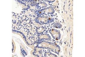 Immunohistochemistry of paraffin embedded mouse duodenum using Cholecystokinin8 (ABIN7073479) at dilution of 1:2000 (400x lens) (Cholecystokinin antibody)