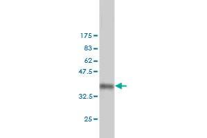 Western Blot detection against Immunogen (36. (ING1 antibody  (AA 41-140))