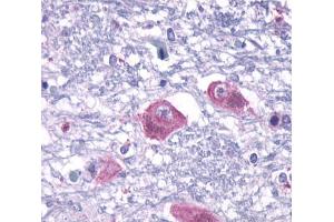 Anti-PTH2R / PTHR2 antibody  ABIN1049268 IHC staining of human brain, neurons and glia.