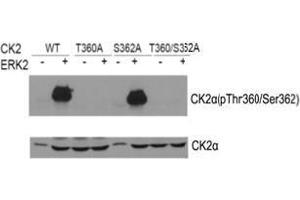 Western blot of CK2α(Phospho-Thr360/Ser362) antibody and CK2αantibody in vitro kinase assay. (CSNK2A1/CK II alpha antibody  (AA 353-357))