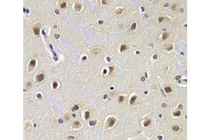 Immunohistochemistry of paraffin-embedded Rat brain using CDKN1B Polyclonal Antibody at dilution of 1:200 (40x lens). (CDKN1B antibody)