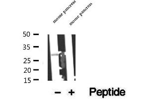 Western blot analysis of extracts of mouse pancreas tissue, using C14orf166 antibody. (C14orf166 antibody)