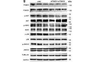 PSMD1 and PSMD2 regulate the expression level of fatty acids (FAs) and lipid synthesis-related genes. (MAPK14 antibody  (pThr180, pTyr182))