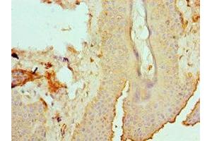 Immunohistochemistry of paraffin-embedded human skin tissue using ABIN7151878 at dilution of 1:100