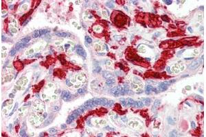 Human Placenta (formalin-fixed, paraffin-embedded) stained with F13A1 antibody ABIN461970 at 5 ug/ml followed by biotinylated secondary antibody, alkaline phosphatase-streptavidin and chromogen. (F13A1 antibody)