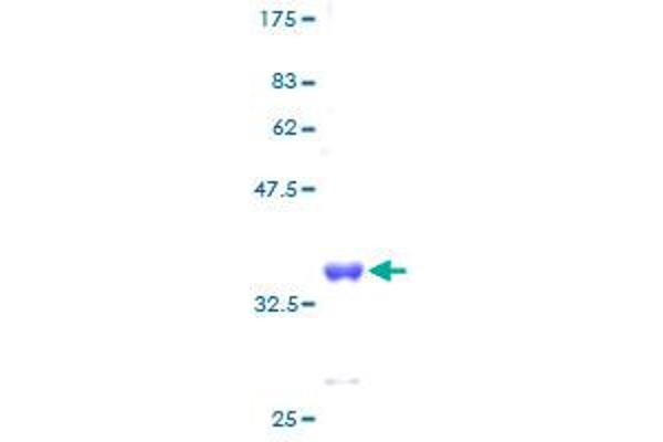 RPS28 Protein (AA 1-69) (GST tag)