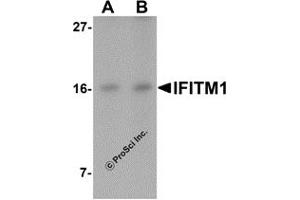 Western Blotting (WB) image for anti-Interferon-Induced Transmembrane Protein 1 (IFITM1) (C-Term) antibody (ABIN1030430) (IFITM1 antibody  (C-Term))