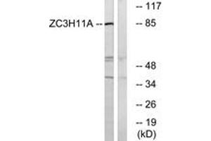 Western blot analysis of extracts from COS cells, using ZC3H11A Antibody. (ZC3H11A antibody  (AA 291-340))