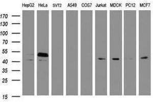 Image no. 4 for anti-SERPINE1 mRNA Binding Protein 1 (SERBP1) (AA 1-262) antibody (ABIN1490678) (SERBP1 antibody  (AA 1-262))