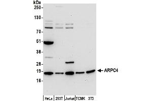 anti-Actin Related Protein 2/3 Complex, Subunit 4, 20kDa (ARPC4) (AA 1-50) antibody