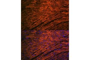 Immunofluorescence analysis of mouse heart using MYL2 Rabbit mAb (ABIN7268761) at dilution of 1:100 (40x lens). (MYL2 antibody)