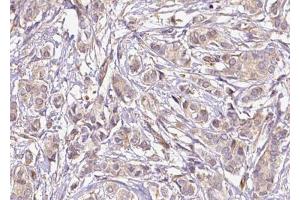 Immunohistochemistry (IHC) image for anti-Mediator Complex Subunit 1 (MED1) (pThr1457) antibody (ABIN6256479)