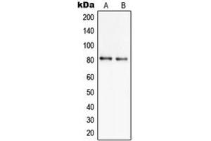 Western blot analysis of SLC6A17 expression in NCIH460 (A), U251MG (B) whole cell lysates. (SLC6A17 antibody  (Center))