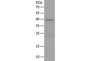 Western Blotting (WB) image for Von Willebrand Factor (VWF) (AA 1498-1665) protein (His-IF2DI Tag) (ABIN7125719) (VWF Protein (AA 1498-1665) (His-IF2DI Tag))