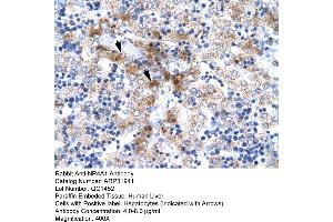 Rabbit Anti-NR4A1 Antibody  Paraffin Embedded Tissue: Human Liver Cellular Data: Hepatocytes Antibody Concentration: 4. (NR4A1 antibody  (N-Term))