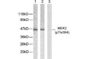 Western blot analysis of extracts from ovary cancer cells using MEK2 (phospho-Thr394) antibody (E011008). (MEK2 antibody  (pThr394))