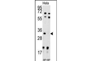 Western blot analysis of anti-UCK2 Antibody (N-term) (ABIN391286 and ABIN2841328) pre-incubated with and without blocking peptide (BP7192a) in Hela cell line lysate. (UCK2 antibody  (N-Term))