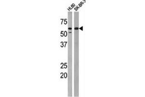 Western Blotting (WB) image for anti-Myelin Transcription Factor 1 (MYT1) (pThr495) antibody (ABIN3001766)