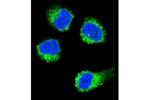 Confocal immunofluorescent analysis of NGFB Antibody (Center) (ABIN392194 and ABIN2841899) with MDA-M cell followed by Alexa Fluor 488-conjugated goat anti-rabbit lgG (green). (NGFB antibody  (AA 84-115))