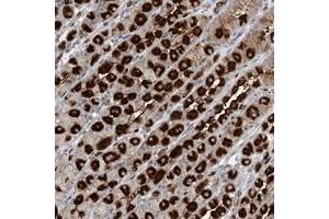 Immunohistochemical staining of human stomach with GIN1 polyclonal antibody  shows strong cytoplasmic positivity in parietal cells at 1:20-1:50 dilution.