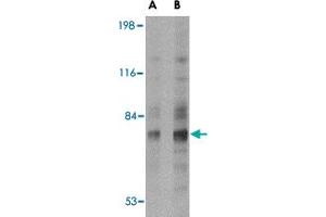 Western blot analysis of SNPH in human brain tissue lysate with SNPH polyclonal antibody  at (A) 2 and (B) 4 ug/mL . (Syntaphilin antibody  (N-Term))