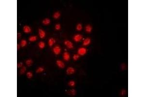 Immunofluorescent analysis of Histone H3 staining in Hela cells. (Histone 3 antibody)