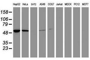 Image no. 1 for anti-Epoxide Hydrolase 1, Microsomal (Xenobiotic) (EPHX1) (AA 21-230) antibody (ABIN1491196) (EPHX1 antibody  (AA 21-230))