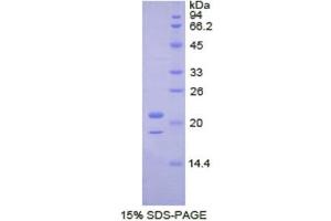 SDS-PAGE (SDS) image for TAR DNA Binding Protein (TARDBP) (AA 104-262) protein (His tag) (ABIN2122176) (TARDBP Protein (AA 104-262) (His tag))