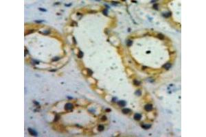 Used in DAB staining on fromalin fixed paraffin-embedded Kidney tissue (Insulin Receptor antibody  (AA 622-945))